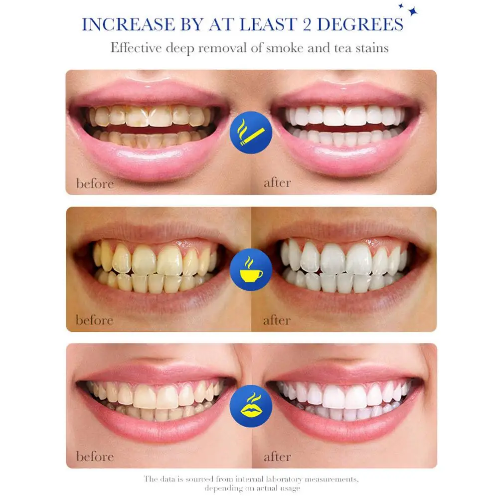 Blanqueador Dental SADOER - Image 5